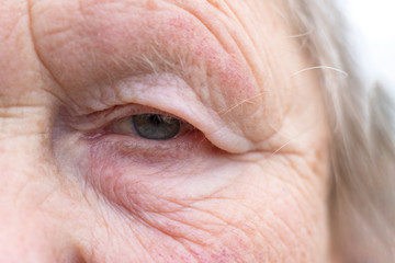 Close-up. Woman aged. Eye in the center of the frame. The pupil has soft focus, the concept of poor...