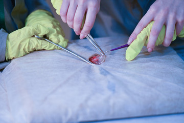 Tumor Removal Training Center. Teaching medicine. Young doctors at a seminar in a hospital.