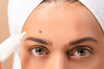 cropped view of woman in towel holding treatment cream near face with problem skin