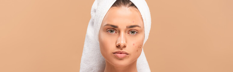 panoramic shot of woman in towel with acne on face isolated on beige
