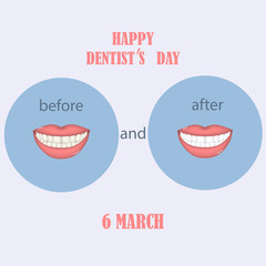 Teeth before and after - professional clean teeth, beautiful smile, red lips - vector. Happy Dentist Day