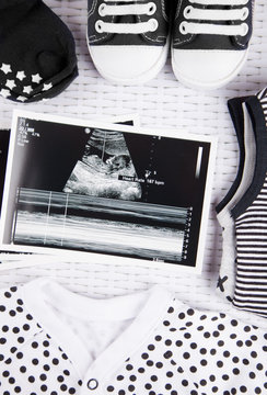 Ultrasound Photo and pregnancy test, gender neutral 