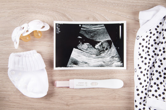 Pregnancy test and baby ultrasound Photo 