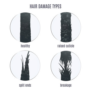 Surface Of Healthy And Damaged Hair Under The Microscope. Hair Follicle Condition Closeup Set. Problem Of Split Ends, Breakage And Raised Cuticle. Trichology Medical Concept. Vector Illustration.