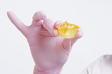 wax for depilation close-up. The girl demonstrates a cosmetic product. The doctor's gloved hand. Sugaring: hair removal with liquid sugar. This is a less painful hair removal with wax replacement