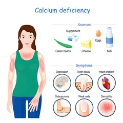 Fotobehang calcium deficiency. Sign, symptoms, and Sources © designua