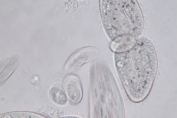 Paramecium caudatum is a genus of unicellular ciliated protozoan and Bacterium under the microscope.