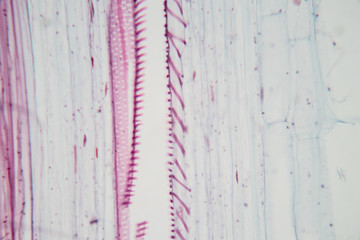  Close up Plant Stem under the microscope for classroom education.