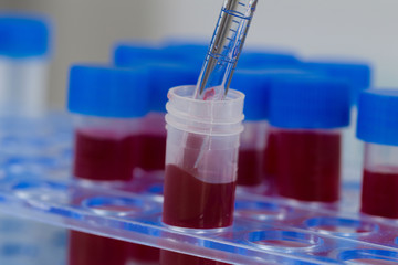 getting a blood probe with a pipette