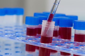 blood samples in a tube rack