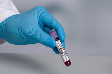 hand in medical gloves holds a human blood probe 