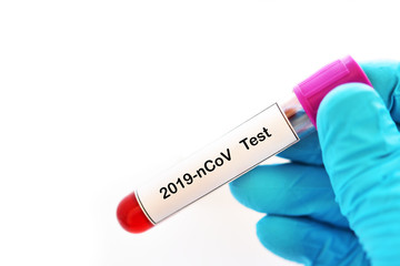Obraz premium Blood sample tube for coronavirus 2019 test, novel coronavirus found in Wuhan, China