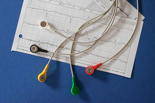 Holter monitoring device and cardiogram on blue  background.