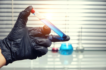 Lab employee in black medical gloves holds a test tube with a blue liquid.Virus, epidemic, and quarantine.