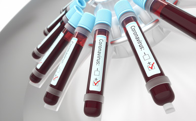 Coronaviruses Respiratory Infections. Coronaviruses, group of viruses that cause diseases in...