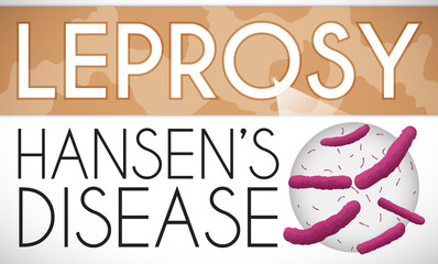 Skin Patches and Enlarged Sample due Hansen's Disease or Leprosy, Vector Illustration