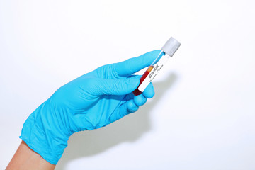  hand  holding test tube with blood sample