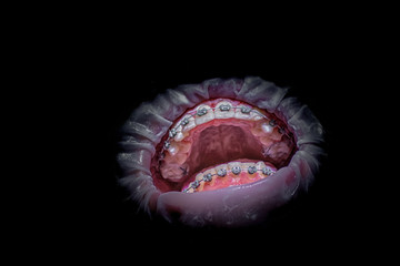 Scary open mouth