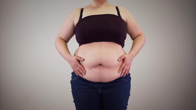 Unrecognizable Caucasian woman shaking fat on tummy. Obese young woman touching belly. Overweight, obesity, unhealthy lifestyle.