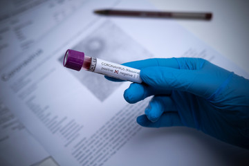 Female hand wearing blue medical gloves hold a sample of blood with coronavirus.