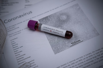 Blood sample with coronavirus lying on medical paper.