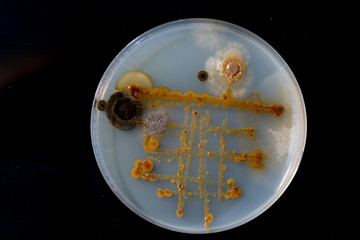petri dish with bacteria, isolated on black