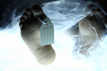 Male leg with tag lies on table in morgue. Chinese corona virus fear concept