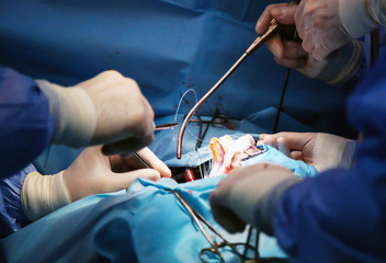 We work with a valve. Valve Replacement. Heart surgery.