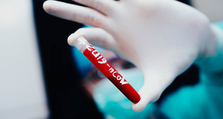epidemic test and blood  in the doctor’s hand  coronavirus test tube 2019 - nCoV, appeared in...