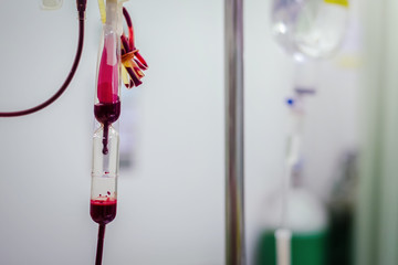Closeup Blood transfusion to a patient in the hospital hand held shooting