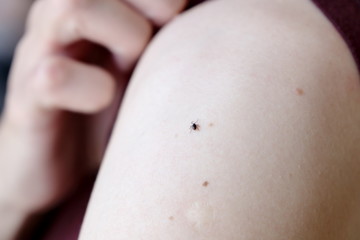 A dangerous encephalitis tick (Ixodes ricinus) creeps on a women’s forearm.