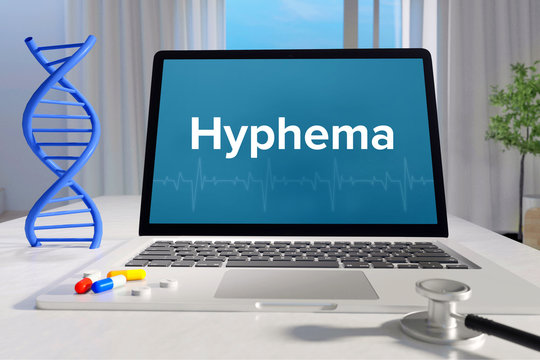 Hyphema&ndash; Medicine/health. Computer in the office with term on the screen. Science/healthcare