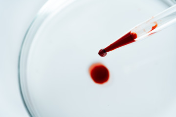 Glass dropper and Petri dish on laboratory table