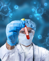 Coronavirus blood test in hospital laboratory