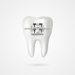 vector tooth braces illustration 3d style - 319491410