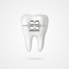 vector tooth braces illustration 3d style - 319491420