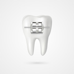 vector tooth braces illustration 3d style