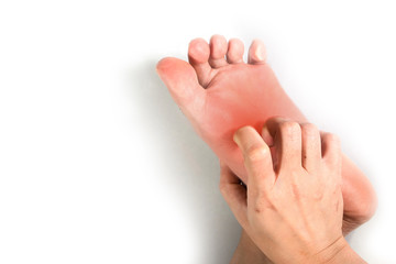 Woman hand scratching on feet with redness rash.