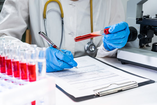 hands of a lab technician with a tube of blood sample and a rack with other samples