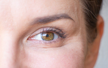 wrinkles under the eyes
