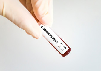 Obraz premium Test tube with blood infected by coronavirus