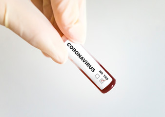 Obraz premium Test tube with blood infected by coronavirus