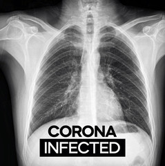 Coronavirus Infected
