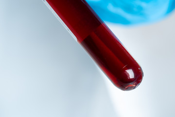 Close up of blood test tube with blood