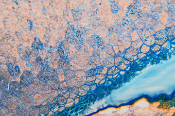 Medical Lab Prepared microscopic- weevil rye