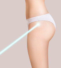 Female hips with blue laser ray removes stretchmarks.