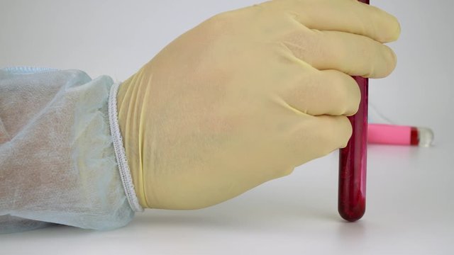 Hand holding blood sample in vacuum tube. Positive test result for the new rapidly spreading Coronavirus, originating in Wuhan, China. 2019-nCoV pandemic, Novel Chinese virus, blood analysis. MERS-Cov