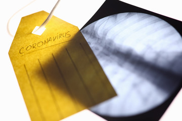 Photograph lung x-ray with tag from carrot lie on doctor table coseup background. Coronavirus...