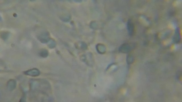 Moving Human Sperm Under Phase Contrast Microscope. Sperm (Spermatozoa) Viewed Under Microscope. Close Up Showing Spermatozoon. Video Human Semen. Macro Closeup. Medical Science Laboratory.