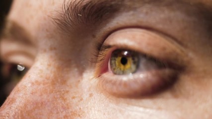 SLOW MOTION Macro Shot of Multi-Colored Eyes Opening in Natural Sunlight